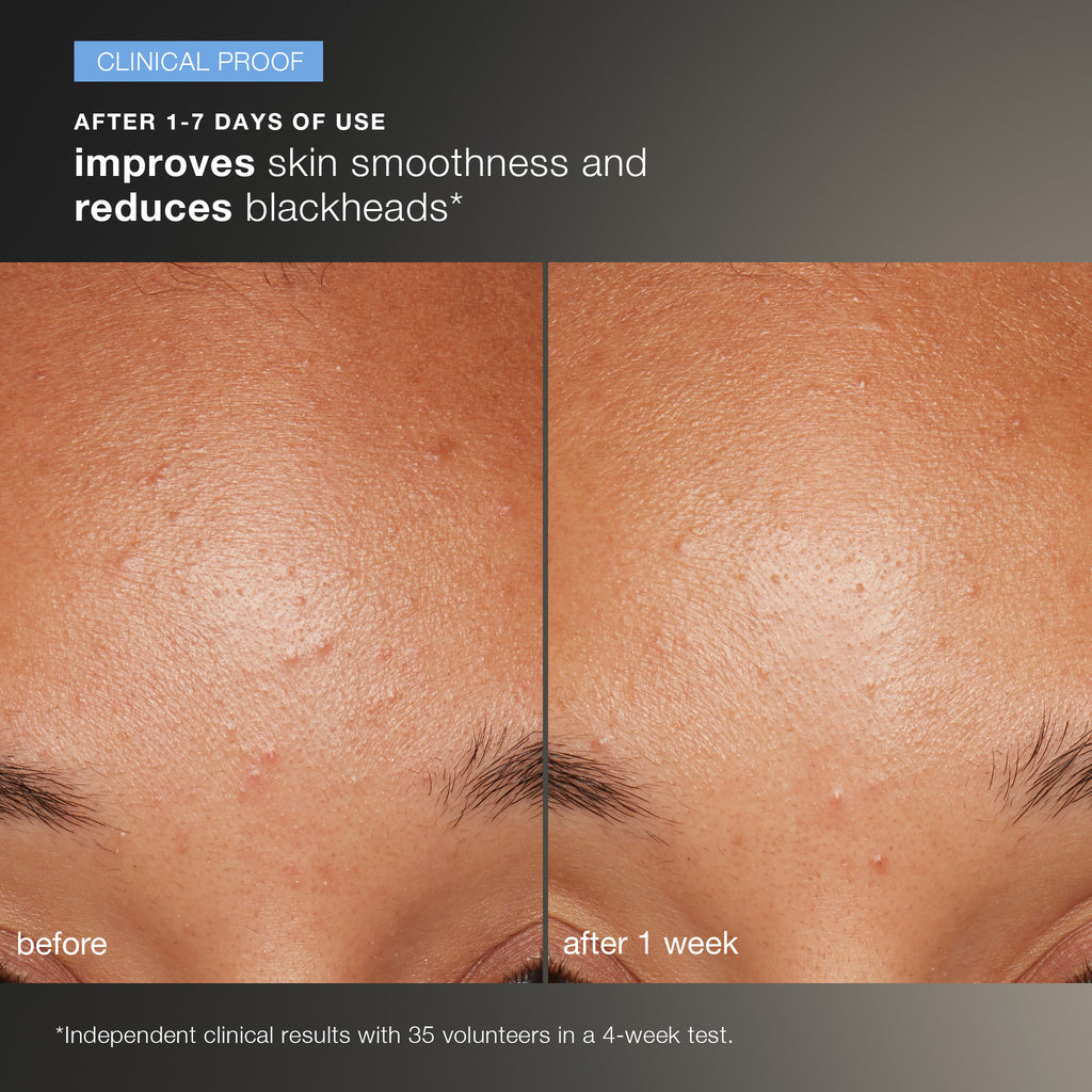 Daily Microfoliant Exfoliator Kit