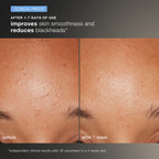 Daily Microfoliant Exfoliator Kit