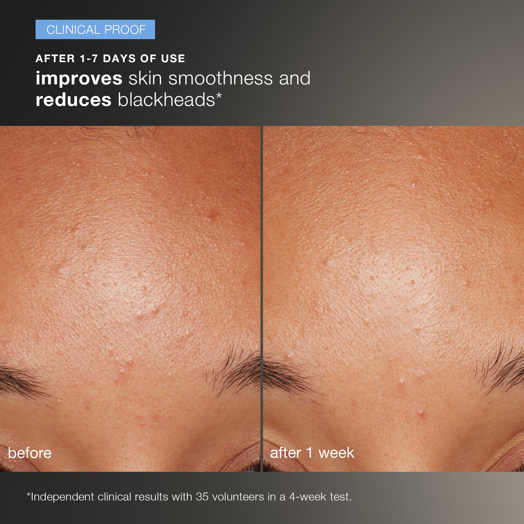 Daily Microfoliant Exfoliator Kit