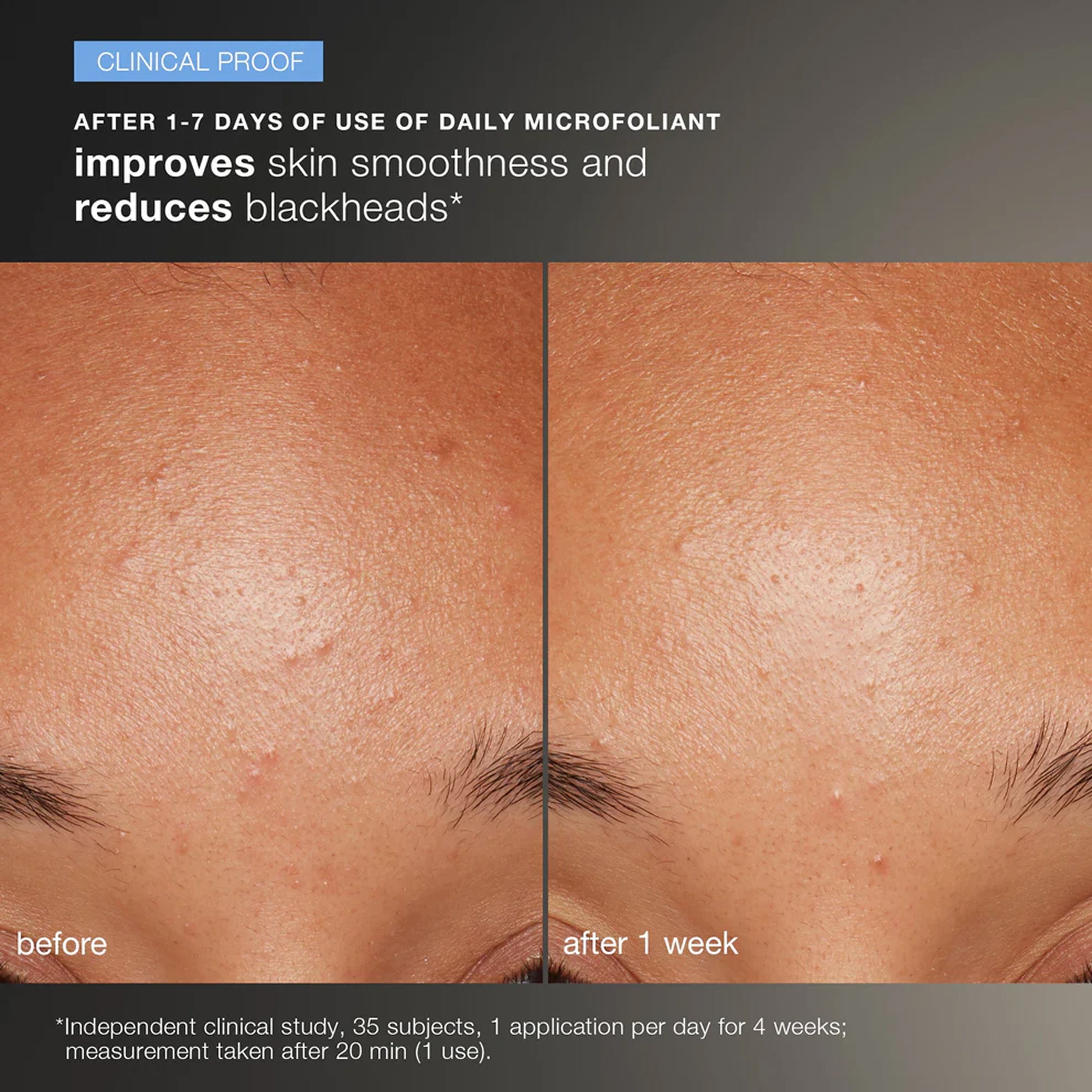 discover healthy skin kit