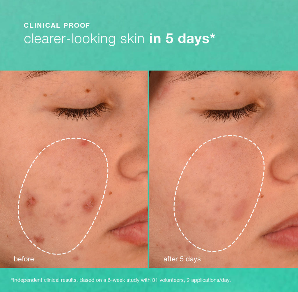 Breakout Biotic Moisturiser