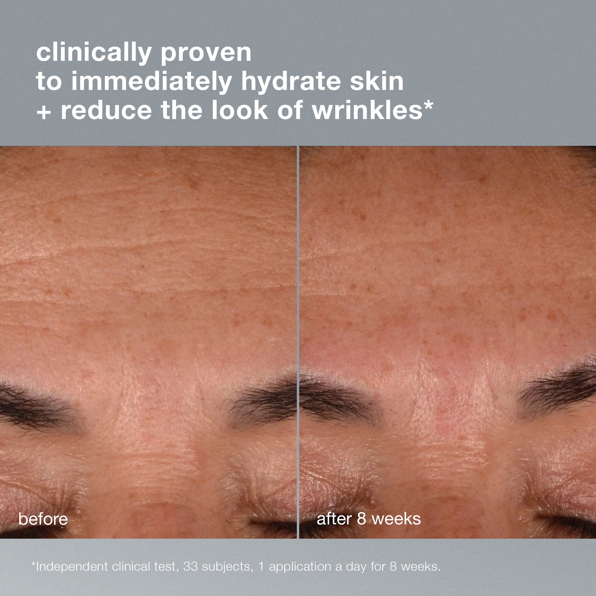 Dynamic Skin Recovery Spf50 Moisturiser