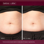 dynamic skin sculptor body serum