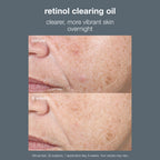 retinol clearing oil